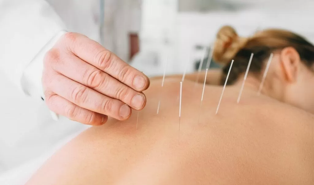 Acupuncture in Freehold , NJ