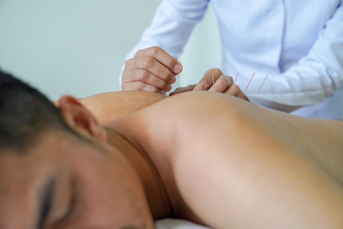 acupuncture for muscle tension